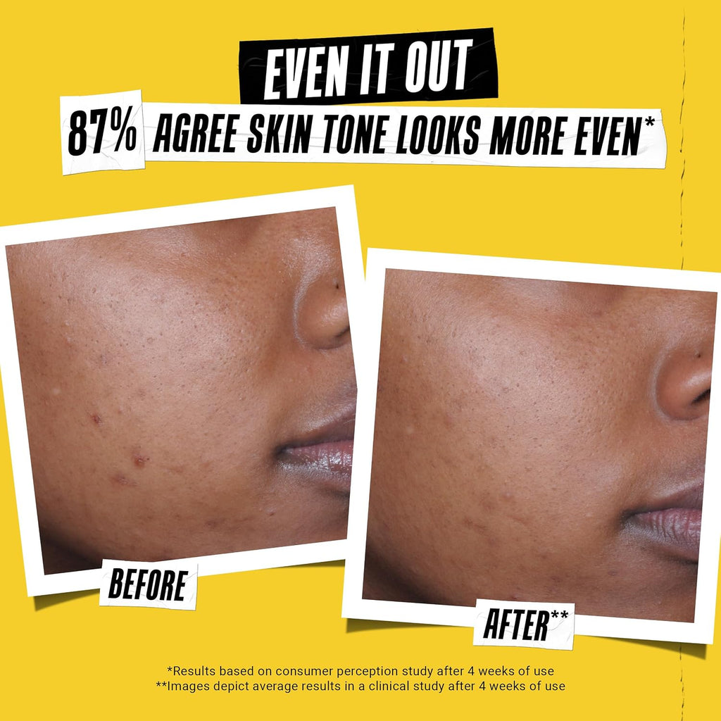 Kiehl'S - Better Screen UV Serum SPF 50+ Facial Sunscreen, Collagen Peptide