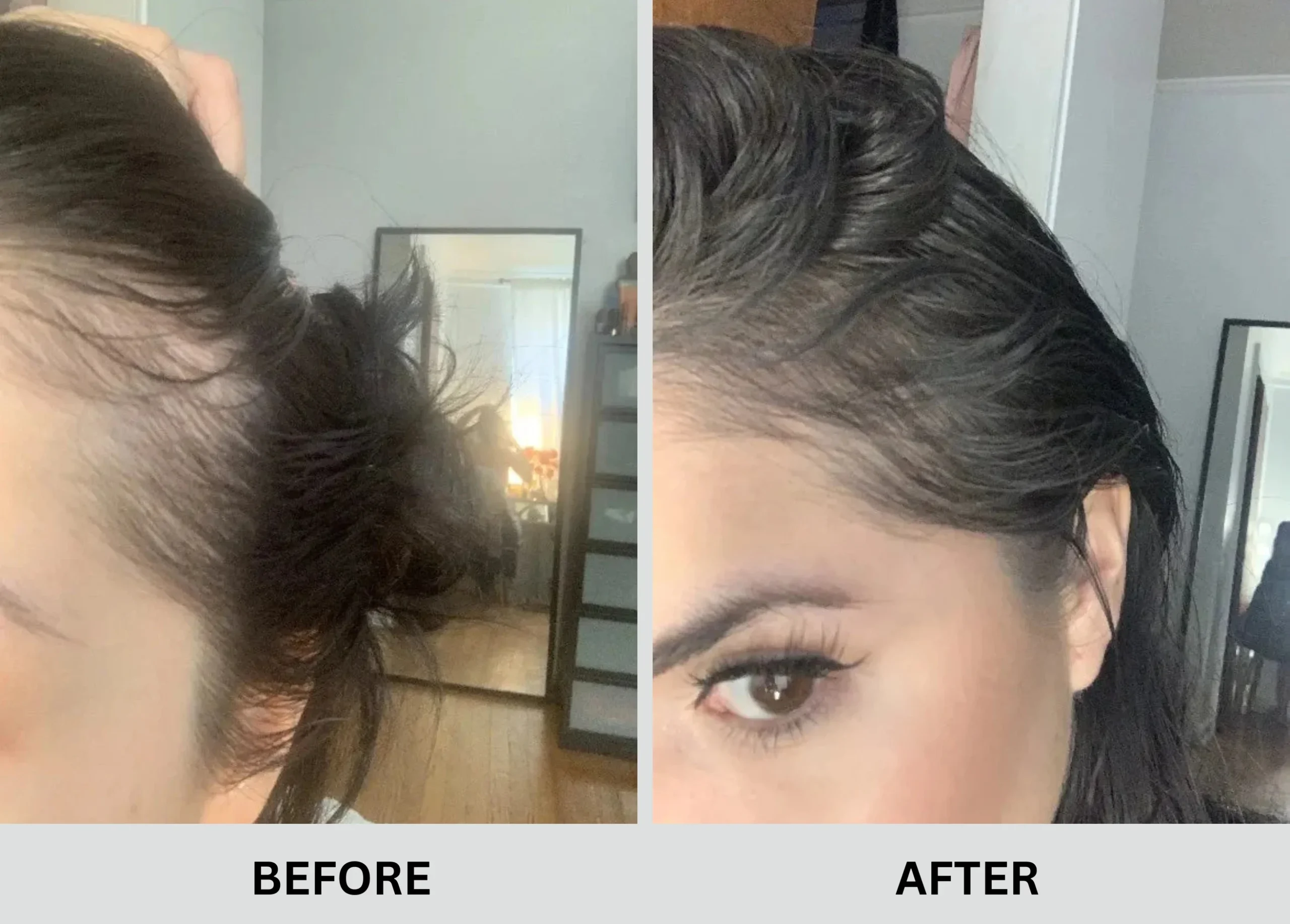 Hair Growth Result 1