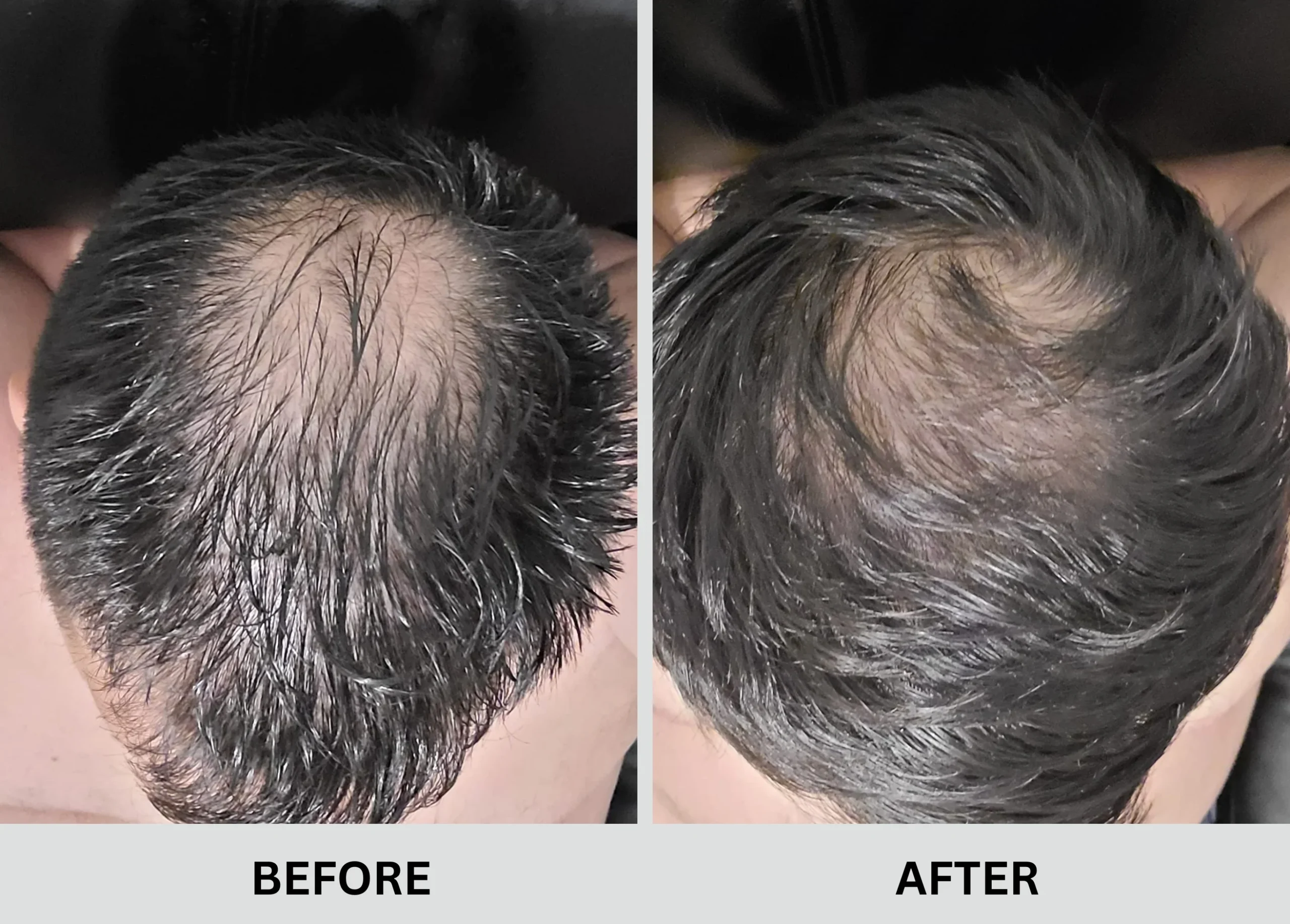 Hair Growth Result 2