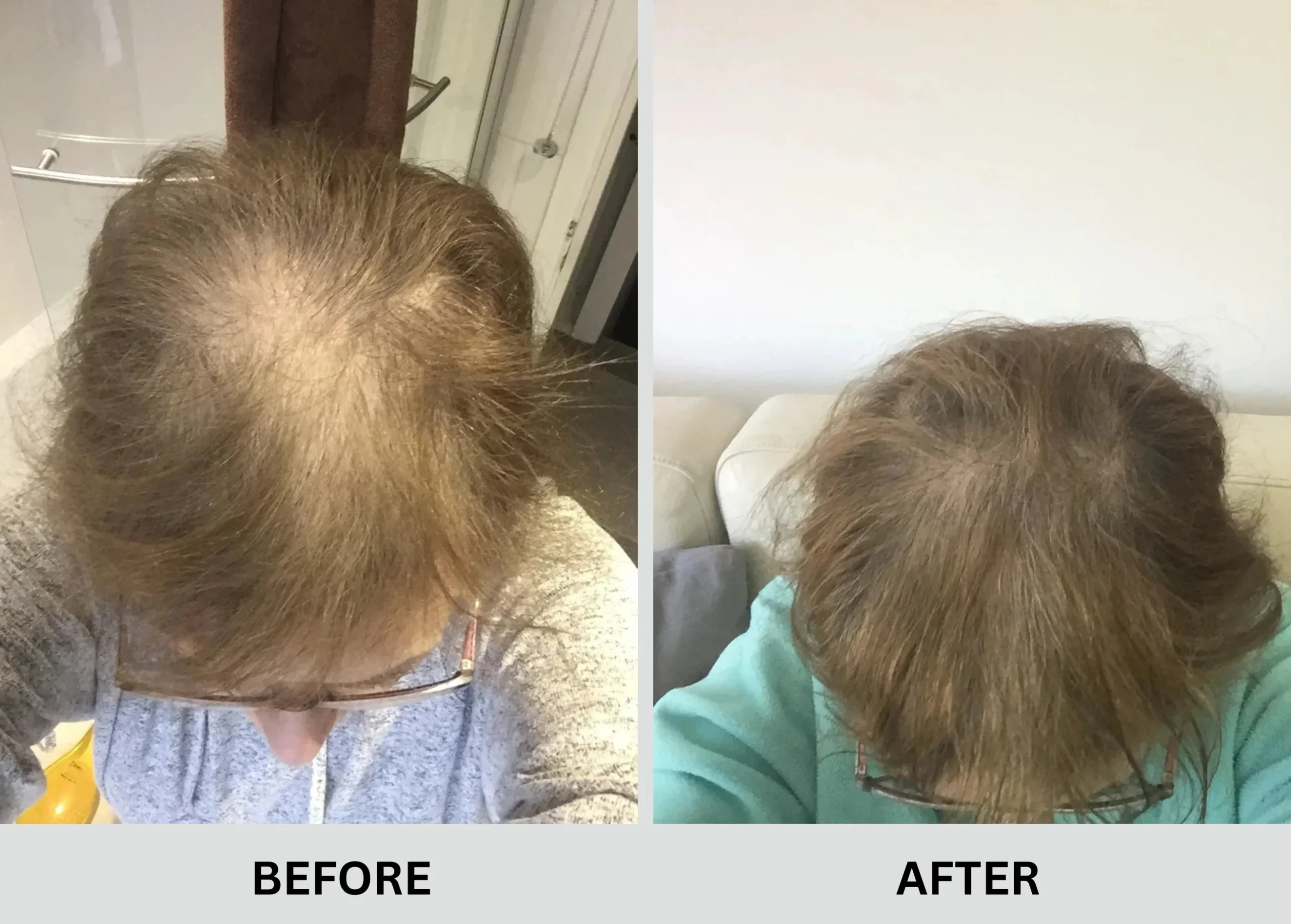 Hair Growth Result 3